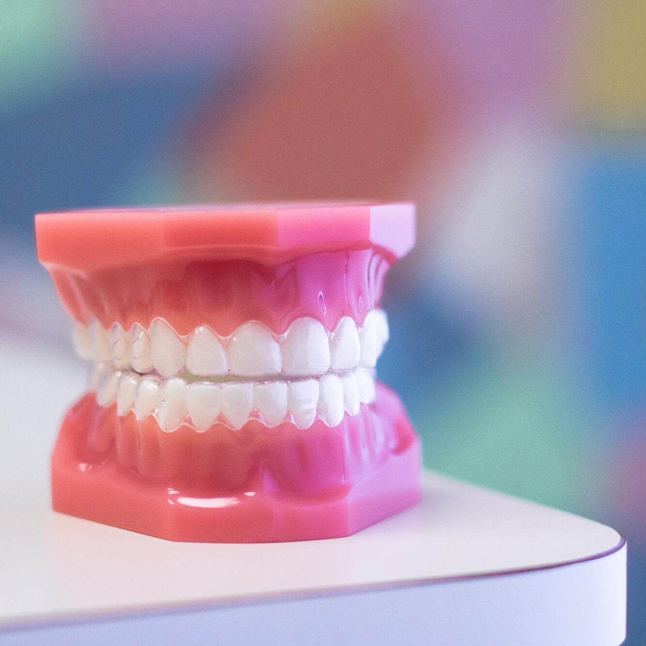 Clear Aligners
