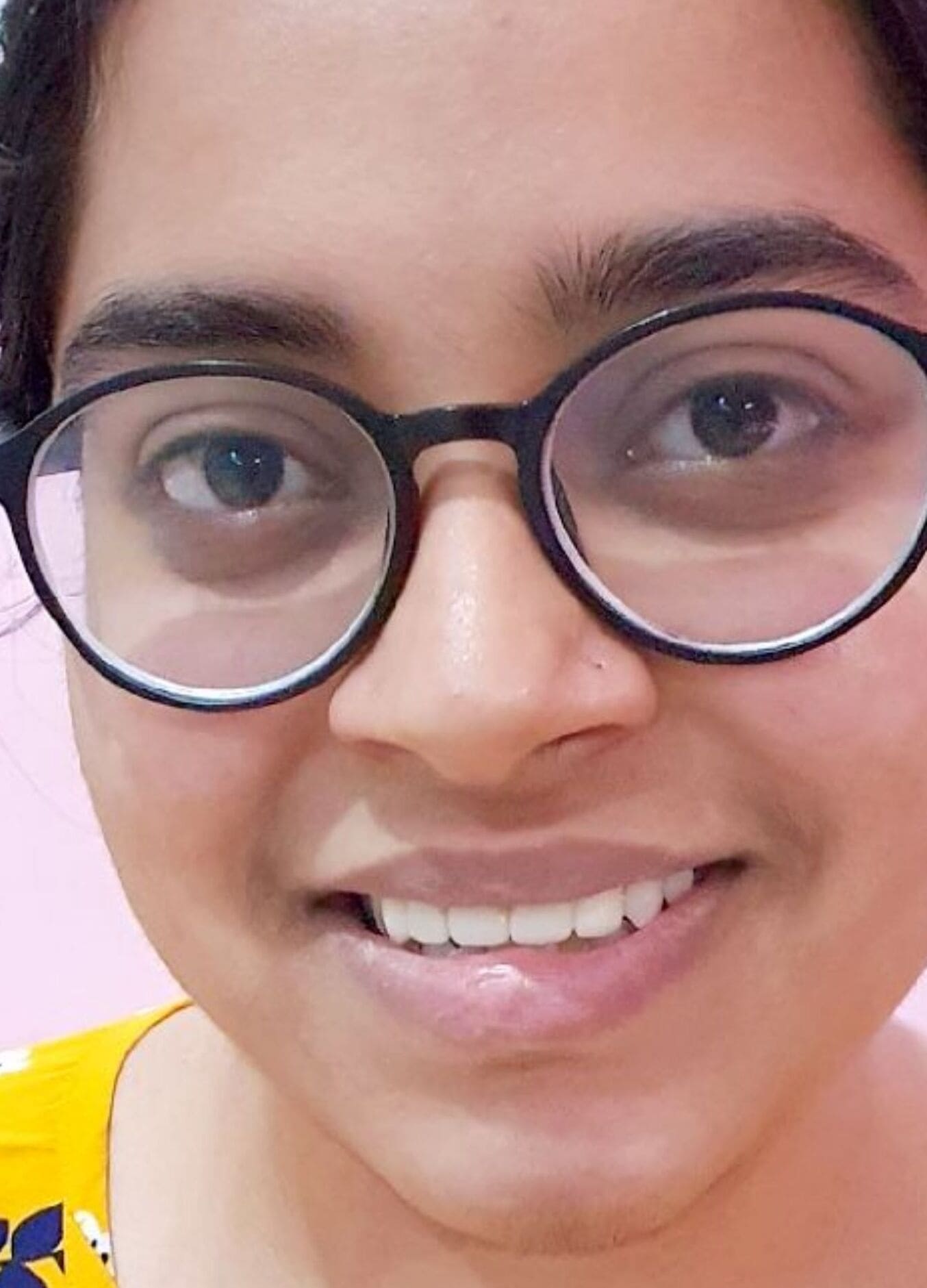 After Fixed Tooth Treatment