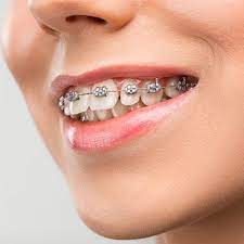 Dental Implant