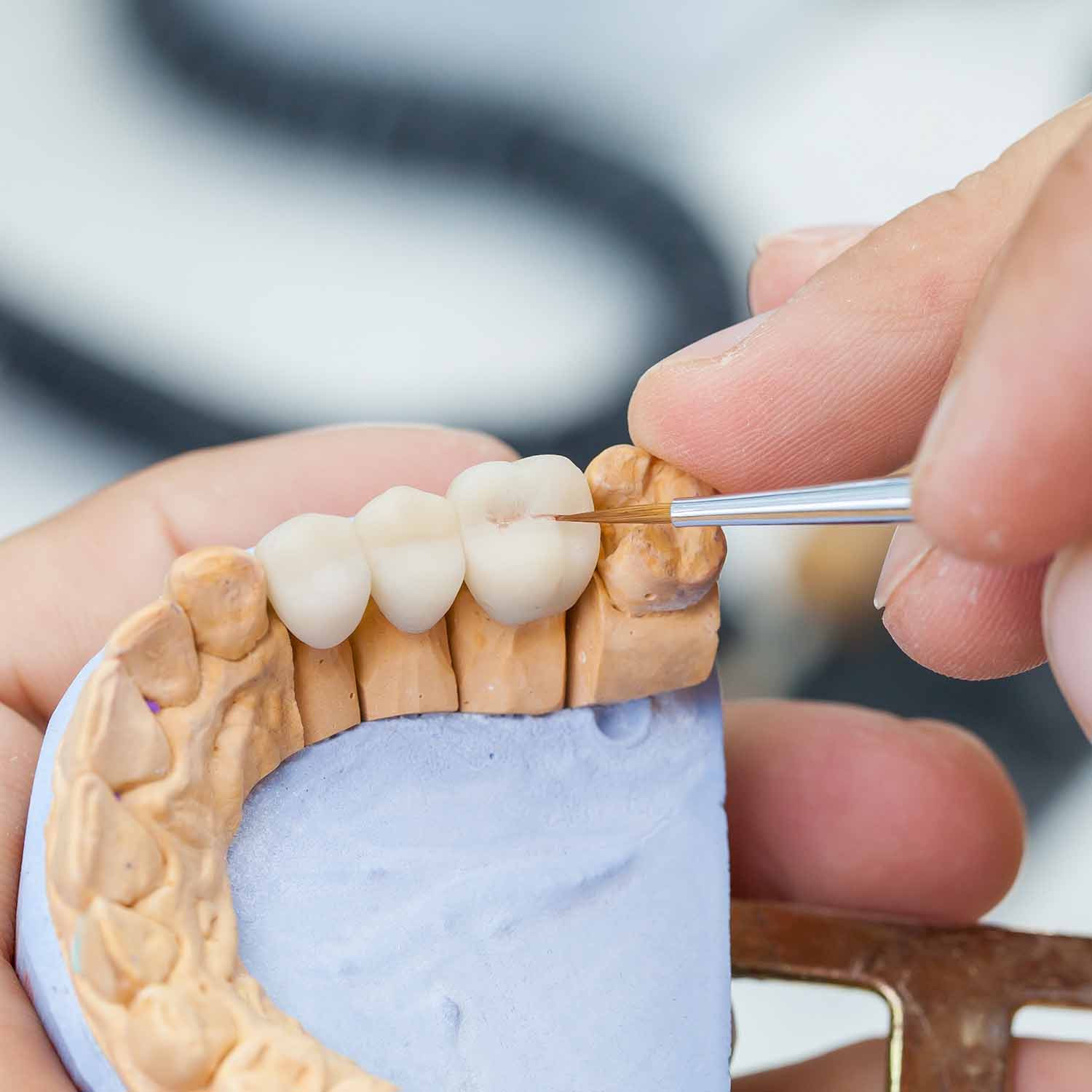Ceramic Crown